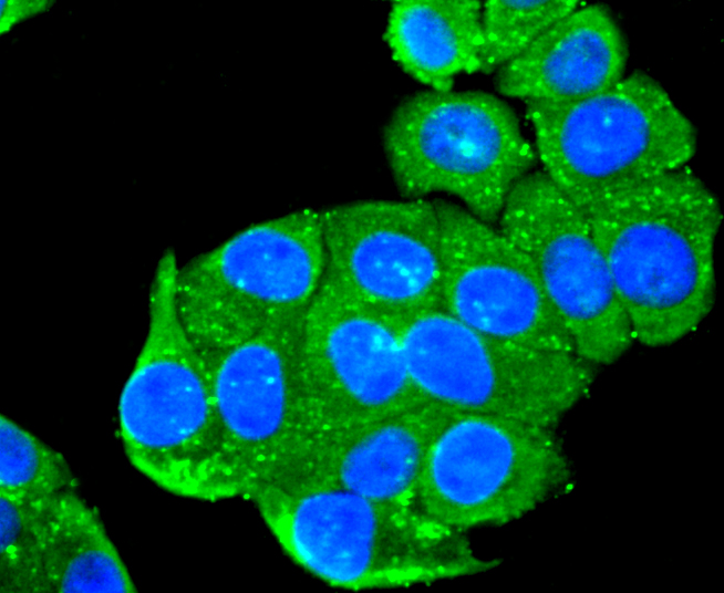 Peroxiredoxin 1 Rabbit mAb