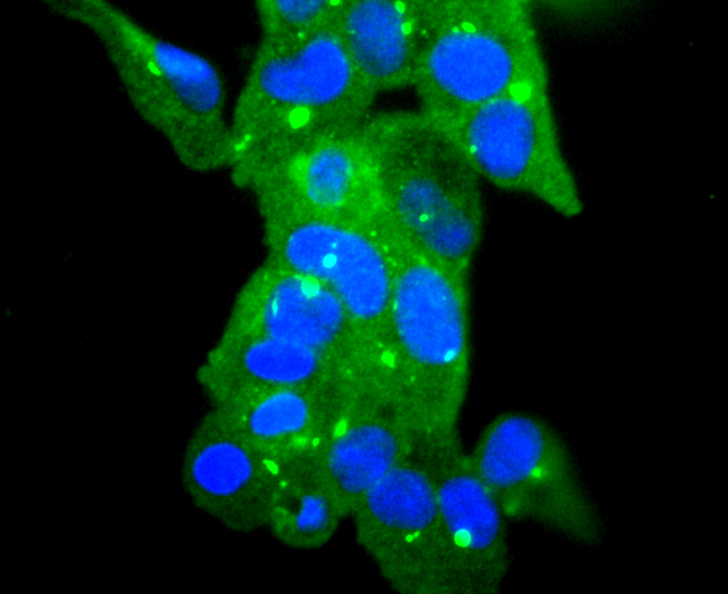 Glutathione Peroxidase 1 Rabbit mAb