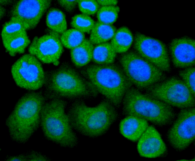 Glutathione Peroxidase 1 Rabbit mAb