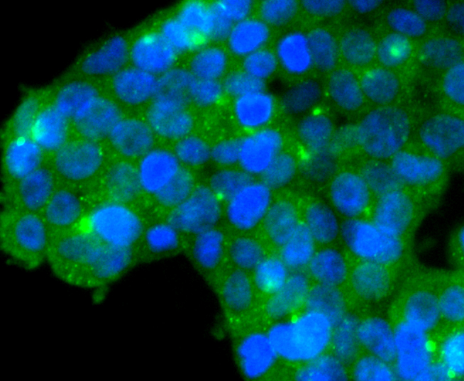 Glutathione Peroxidase 1 Rabbit mAb