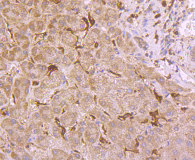 Glutathione Peroxidase 1 Rabbit mAb