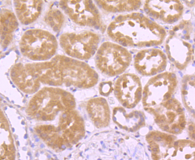 Glutathione Peroxidase 1 Rabbit mAb