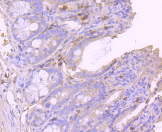 Glutathione Peroxidase 1 Rabbit mAb