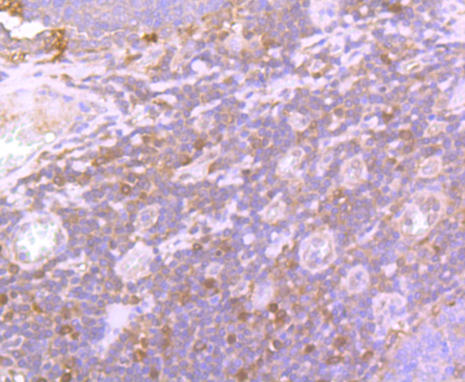 Glutathione Peroxidase 1 Rabbit mAb