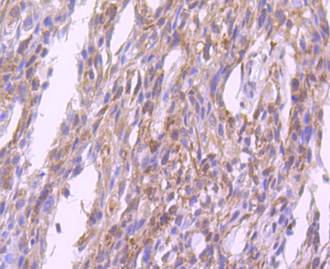 Glutathione Peroxidase 1 Rabbit mAb