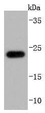 Glutathione Peroxidase 1 Rabbit mAb