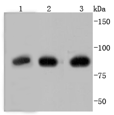 Glucocorticoid Receptor Rabbit mAb