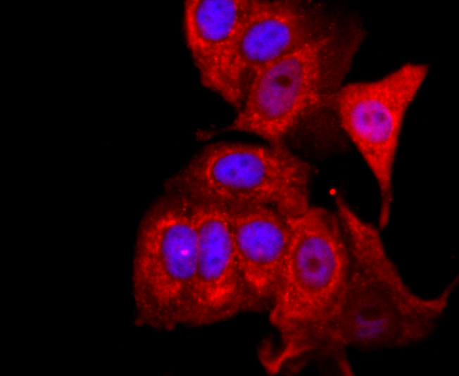 FOXP3 Rabbit mAb