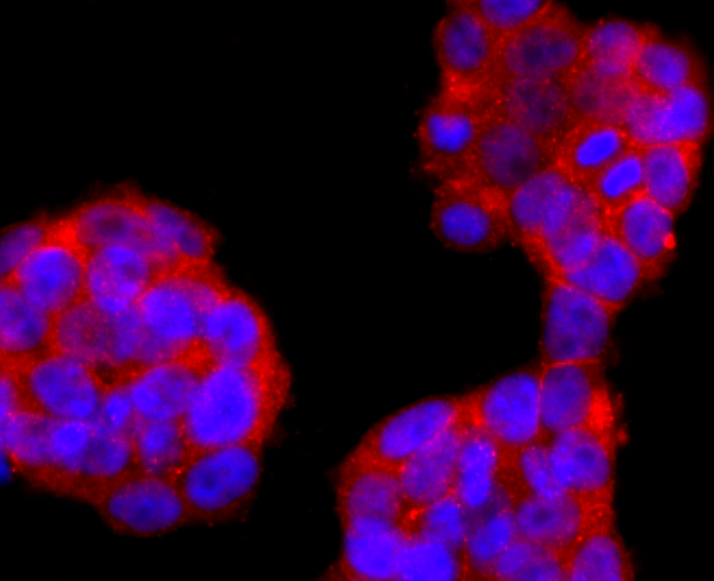 FOXP3 Rabbit mAb