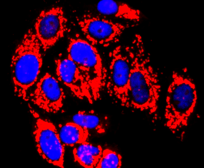 MMP13 Rabbit mAb