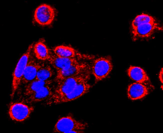 MMP13 Rabbit mAb