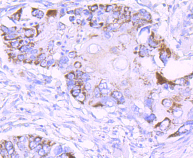 MMP13 Rabbit mAb