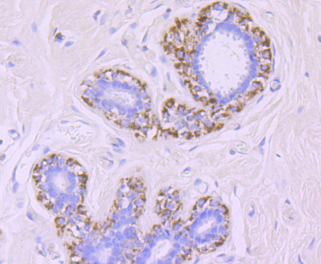 MMP13 Rabbit mAb