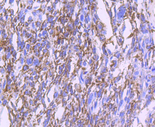 MMP13 Rabbit mAb