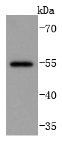 MMP13 Rabbit mAb