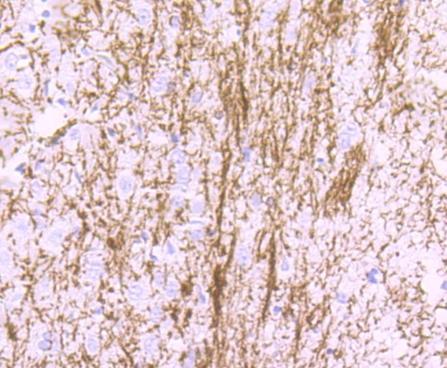 Myelin Basic Protein Rabbit mAb