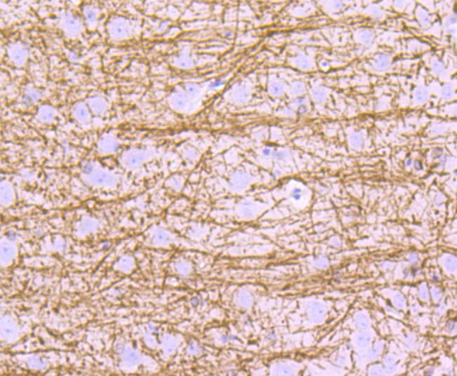 Myelin Basic Protein Rabbit mAb