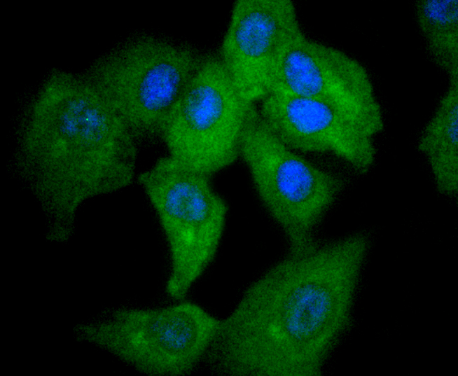 STAT2 Rabbit mAb