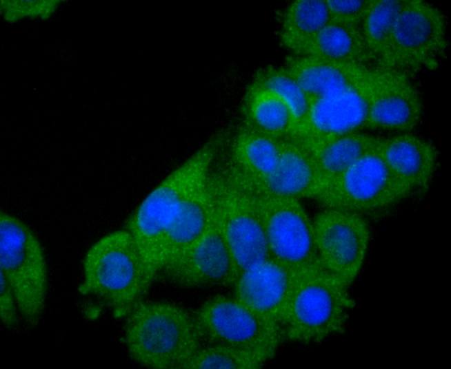 STAT2 Rabbit mAb