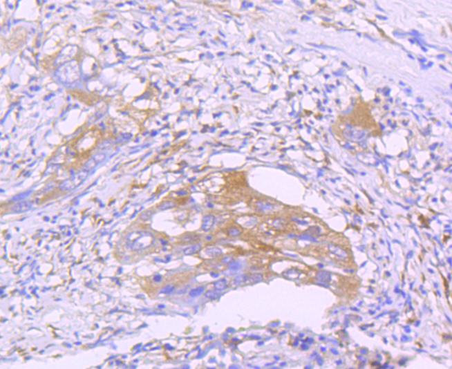 STAT2 Rabbit mAb