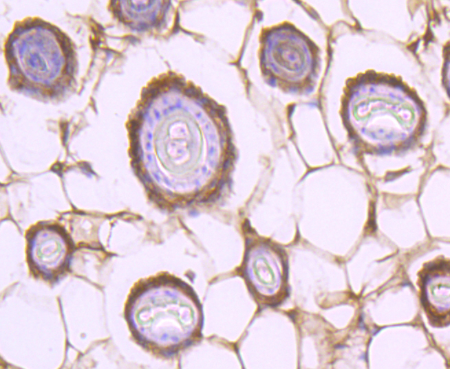 STAT2 Rabbit mAb