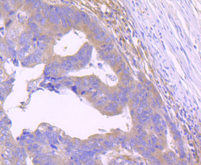 STAT2 Rabbit mAb