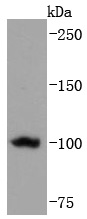 Telomerase reverse transcriptase Rabbit mAb