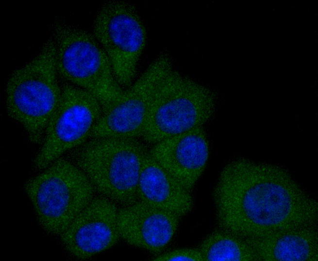 Apolipoprotein A1 Rabbit mAb