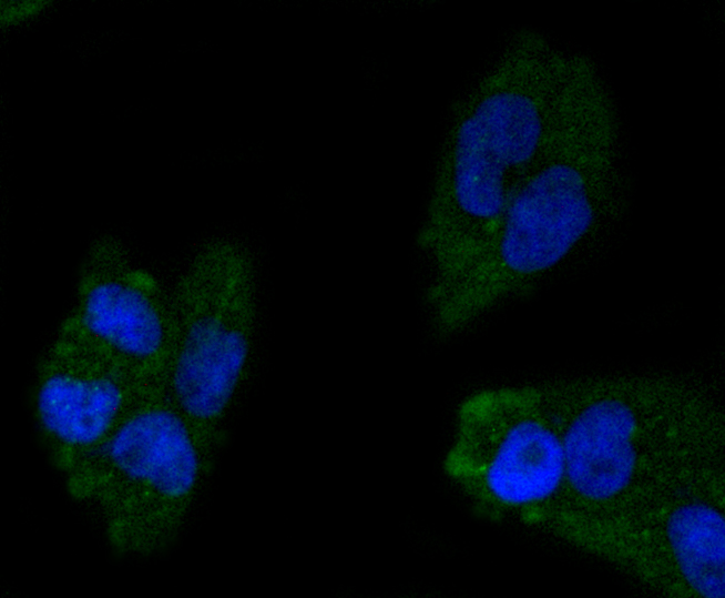 Apolipoprotein A1 Rabbit mAb