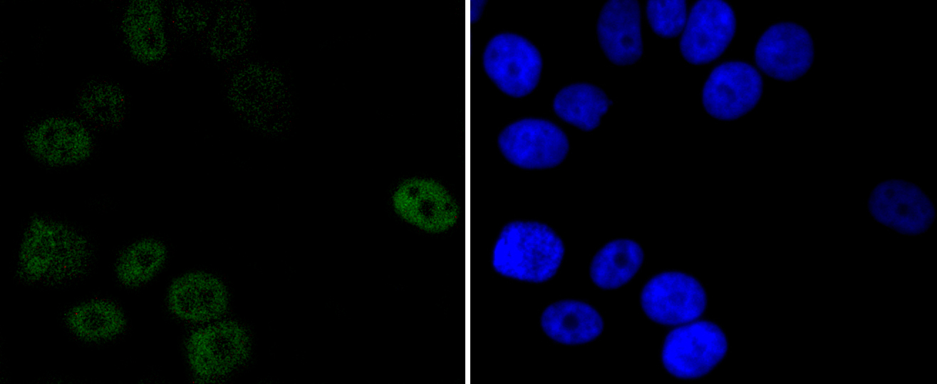 Progesterone Receptor Rabbit mAb