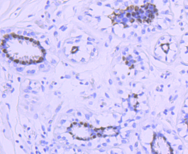 Progesterone Receptor Rabbit mAb