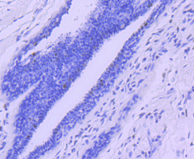 Progesterone Receptor Rabbit mAb