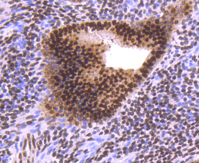 Progesterone Receptor Rabbit mAb