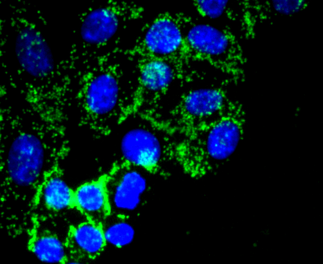 Fibronectin Rabbit mAb