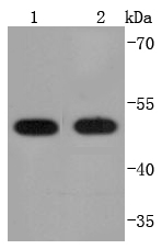 PDIA6 Rabbit mAb