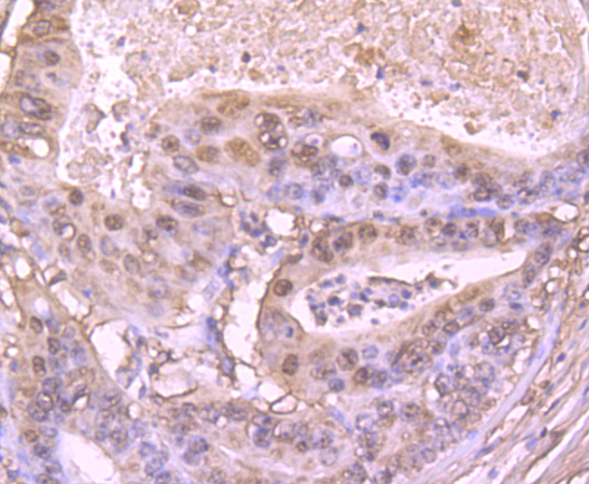 S100 alpha 6 Rabbit mAb