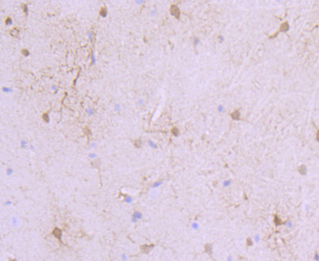 S100 alpha 6 Rabbit mAb