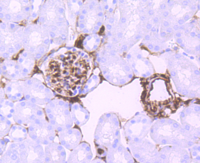 S100 alpha 6 Rabbit mAb