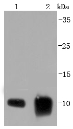 S100 alpha 6 Rabbit mAb