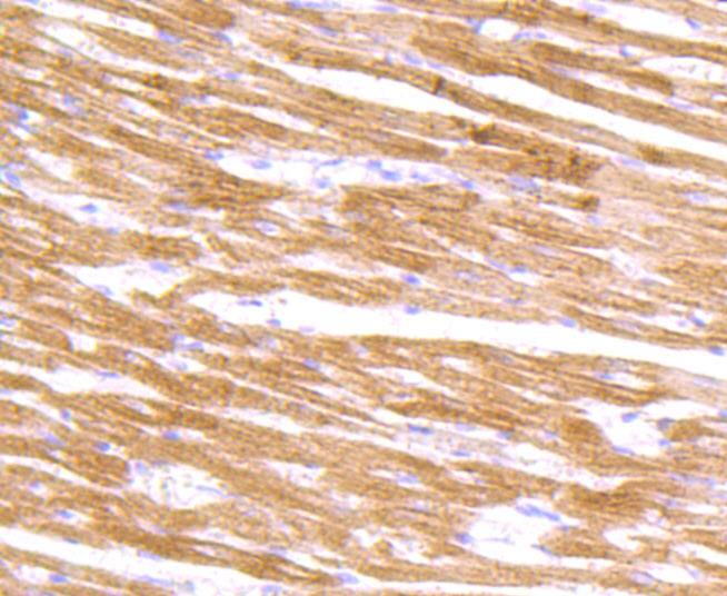 Alpha Actinin 2 Rabbit mAb