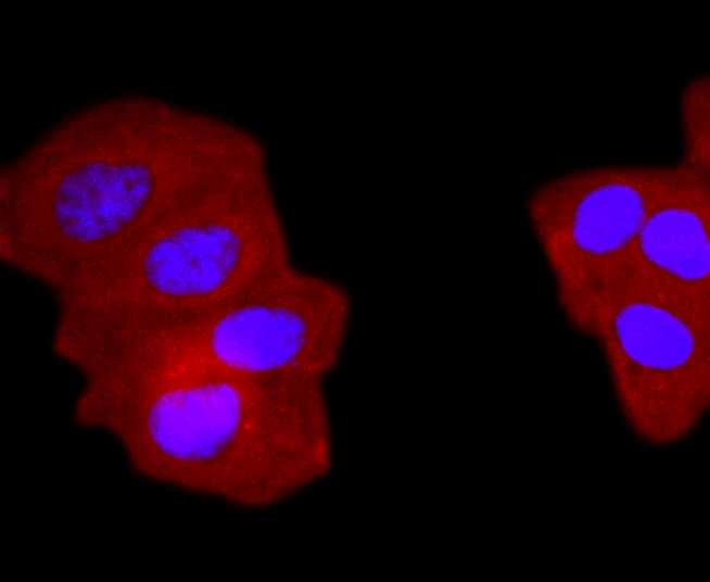 gamma Tubulin Rabbit mAb