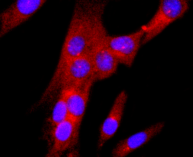 gamma Tubulin Rabbit mAb