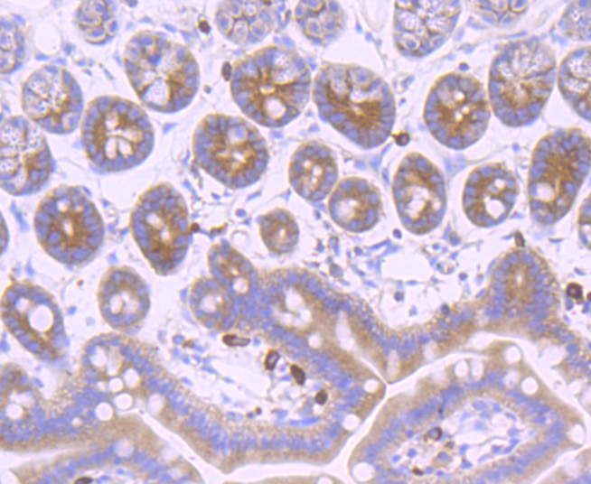 gamma Tubulin Rabbit mAb