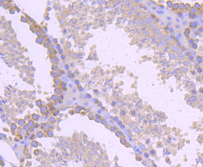 gamma Tubulin Rabbit mAb