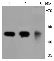 gamma Tubulin Rabbit mAb