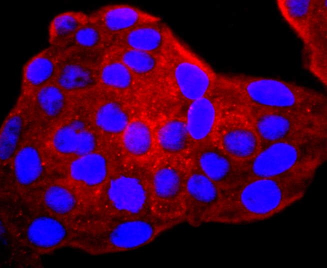 gamma Catenin Rabbit mAb