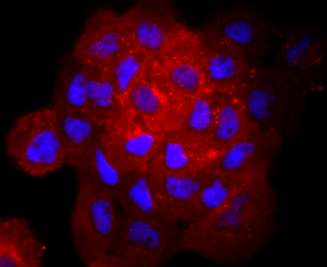 gamma Catenin Rabbit mAb