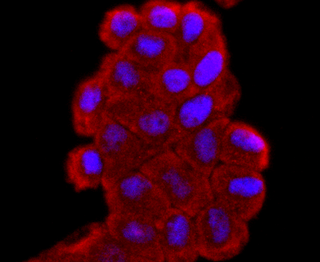 Superoxide Dismutase 1 Rabbit mAb