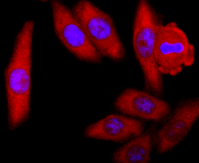 Superoxide Dismutase 1 Rabbit mAb