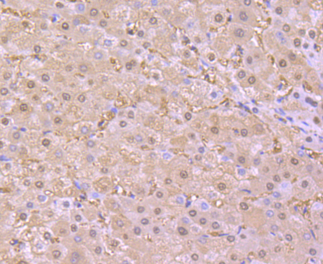 Superoxide Dismutase 1 Rabbit mAb